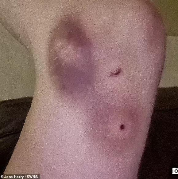 松鼠发狂咬人,松鼠疯狂咬人