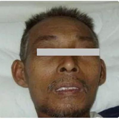 厌食腹胀怎么解决,胃炎胀气厌食