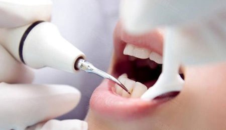 年纪大了牙齿变短是什么原因,年纪大了牙齿变长