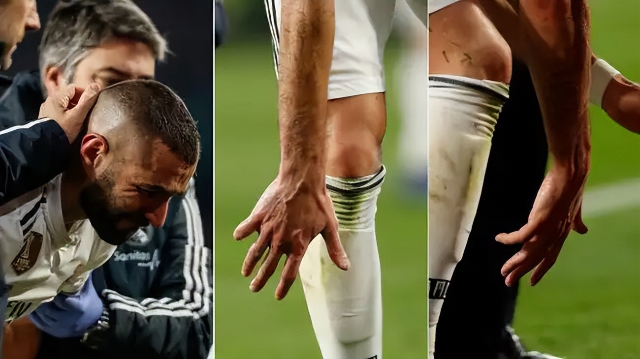 世界杯法国队不利因素,世界杯法国队有因伤退出的吗