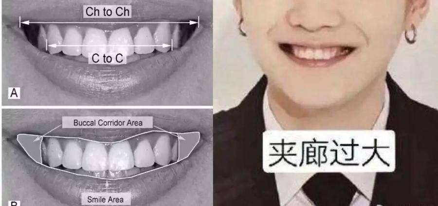 国民初恋毁容了,国民初恋盛世美颜