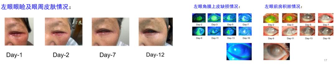 鐪肩鍖荤敓鍐簯,鍖楀尰涓夐櫌鐪肩涓撳鍐簯