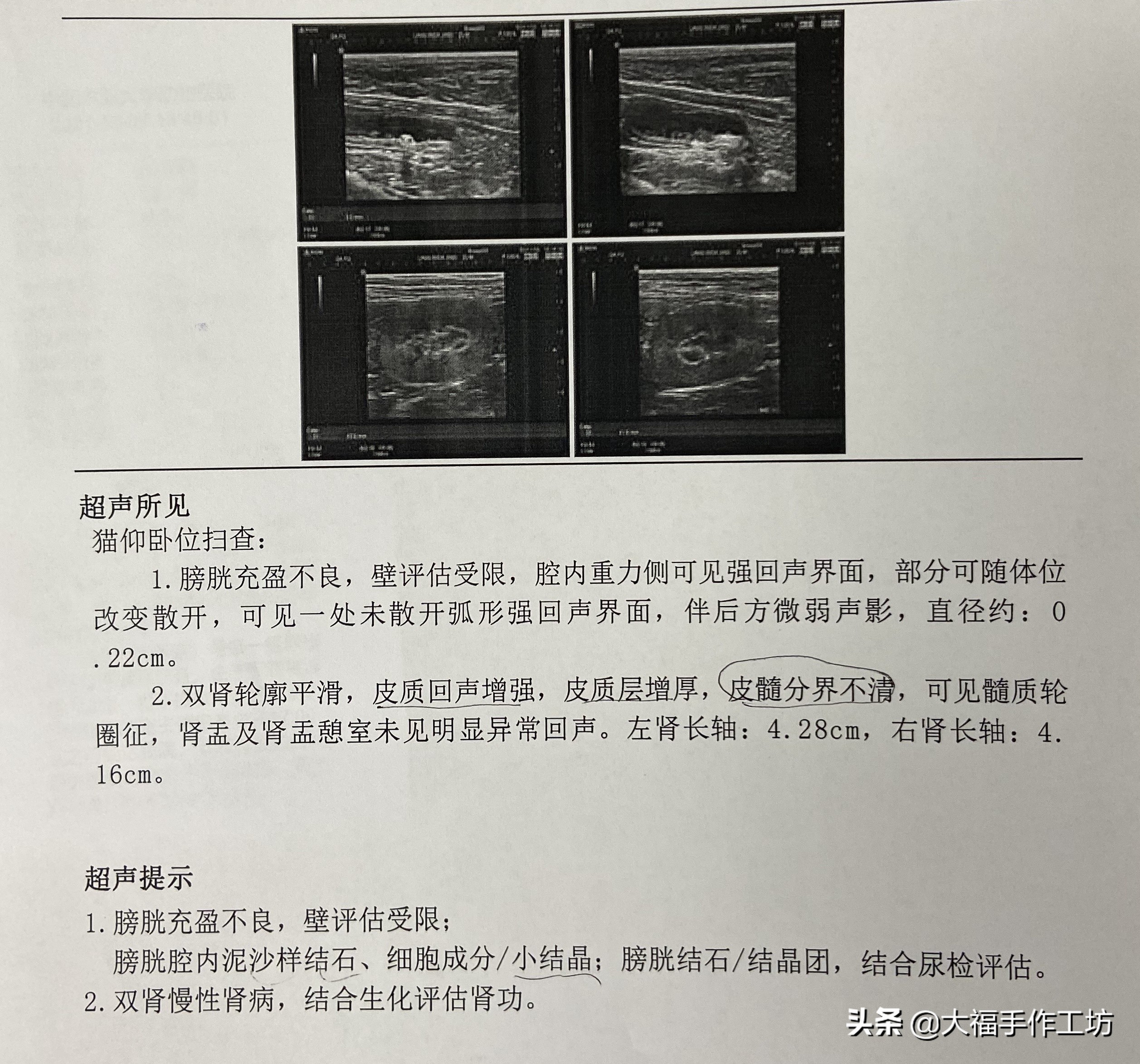 猫咪膀胱有结晶导致膀胱炎,猫膀胱结晶手术多少钱