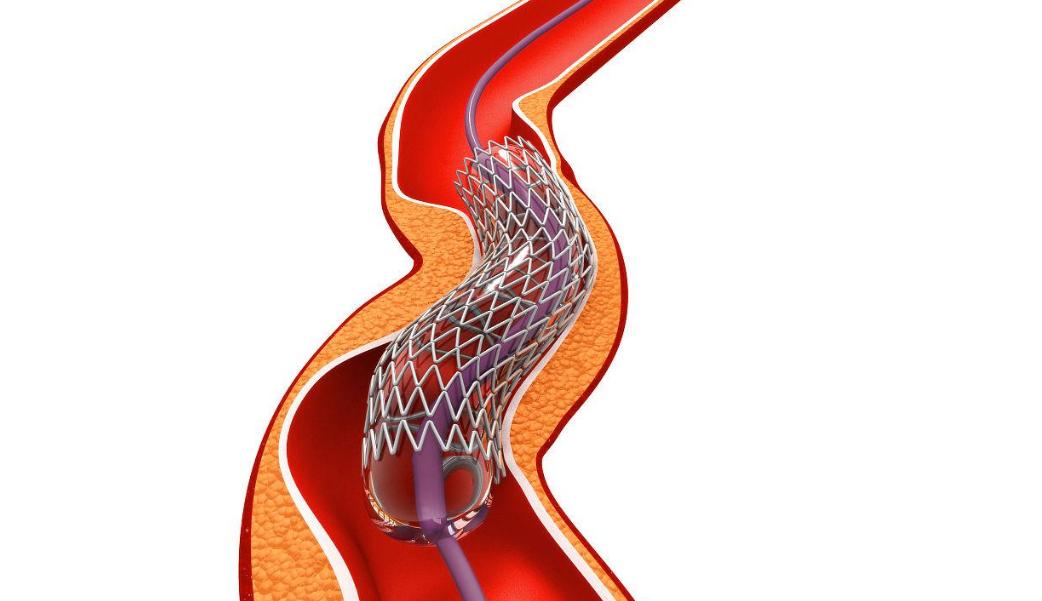 为什么吸烟能引起心梗呢,吸烟为什么会导致心梗