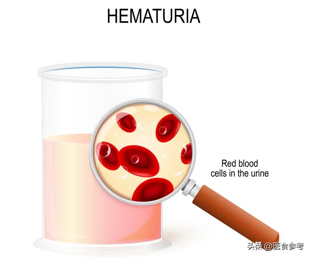 身体出现的十大信号可能是癌症,身体提示6个信号肝出问题了