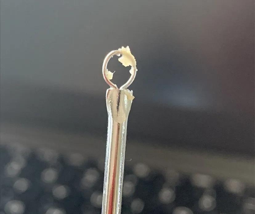 鼻子黑头里挤出的白色油脂怎么办,鼻子上有硬硬的黑头怎么办