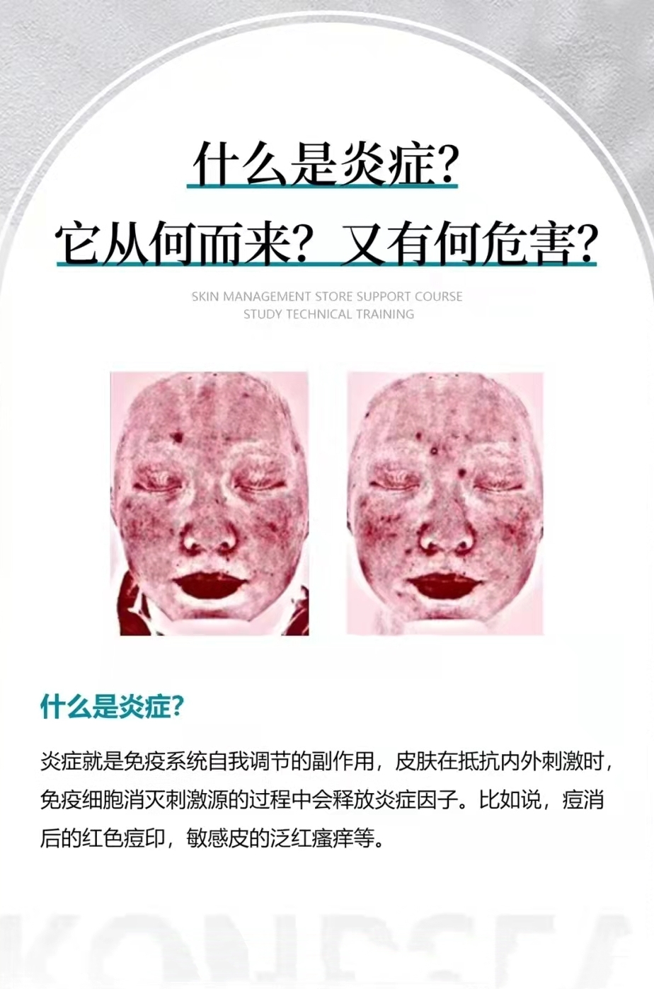 皮肤炎症感染严重吗,皮肤炎症有可能影响血液吗