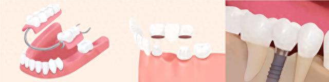 怎么彻底解决牙齿问题,有快速牙齿矫正方法吗