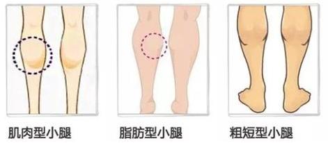 高周波吸脂瘦腿,吸脂可以瘦咬肌吗