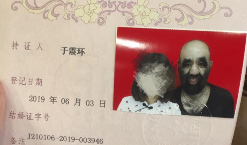 当年轰动一时的“毛孩”：42岁娶90后娇妻，生下一子未遗传长毛