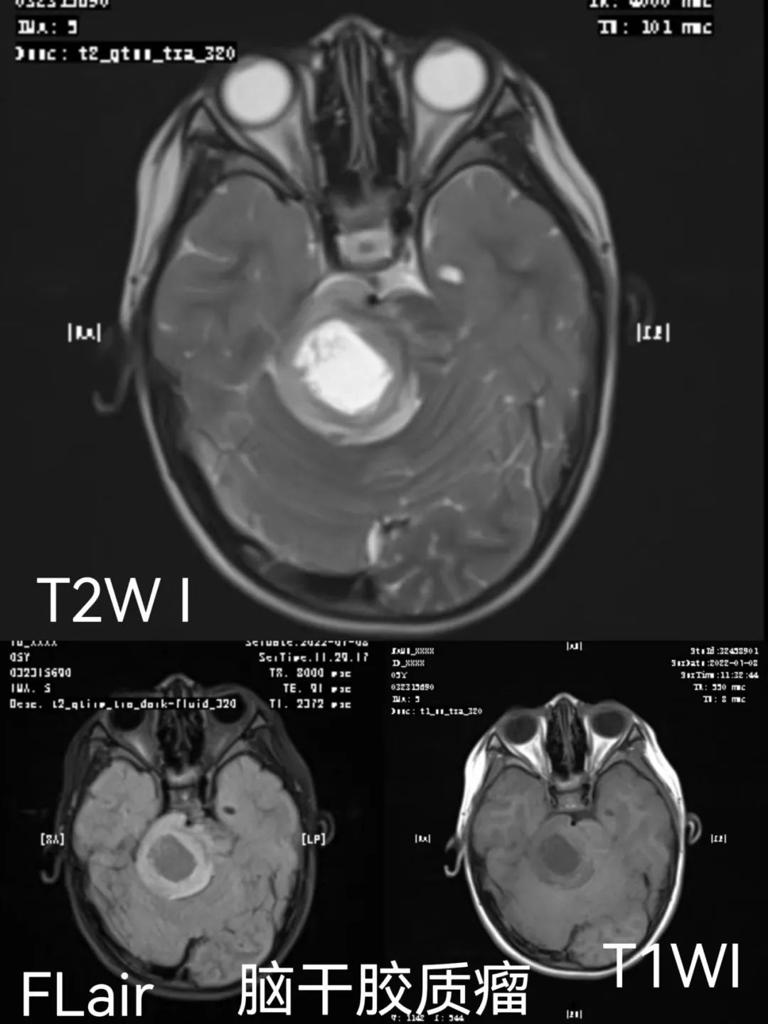 致敬公司的摄影师,美女致敬摄影师视频