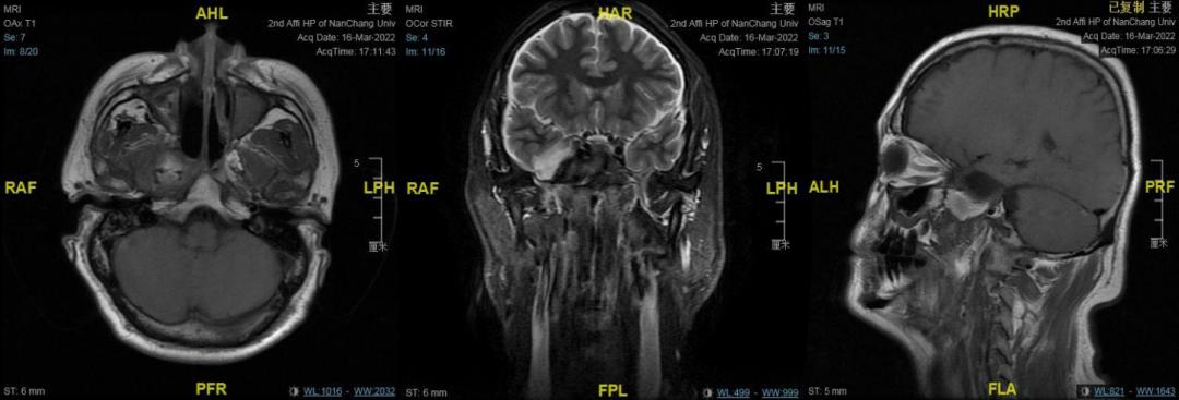 南昌二附院耳鼻喉科手术,南昌大学第二附属医院耳鼻咽喉科