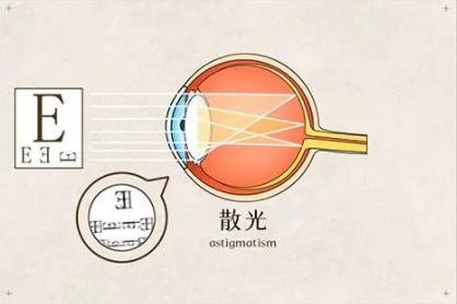 南阳南石眼科,病理性散光原因有几种
