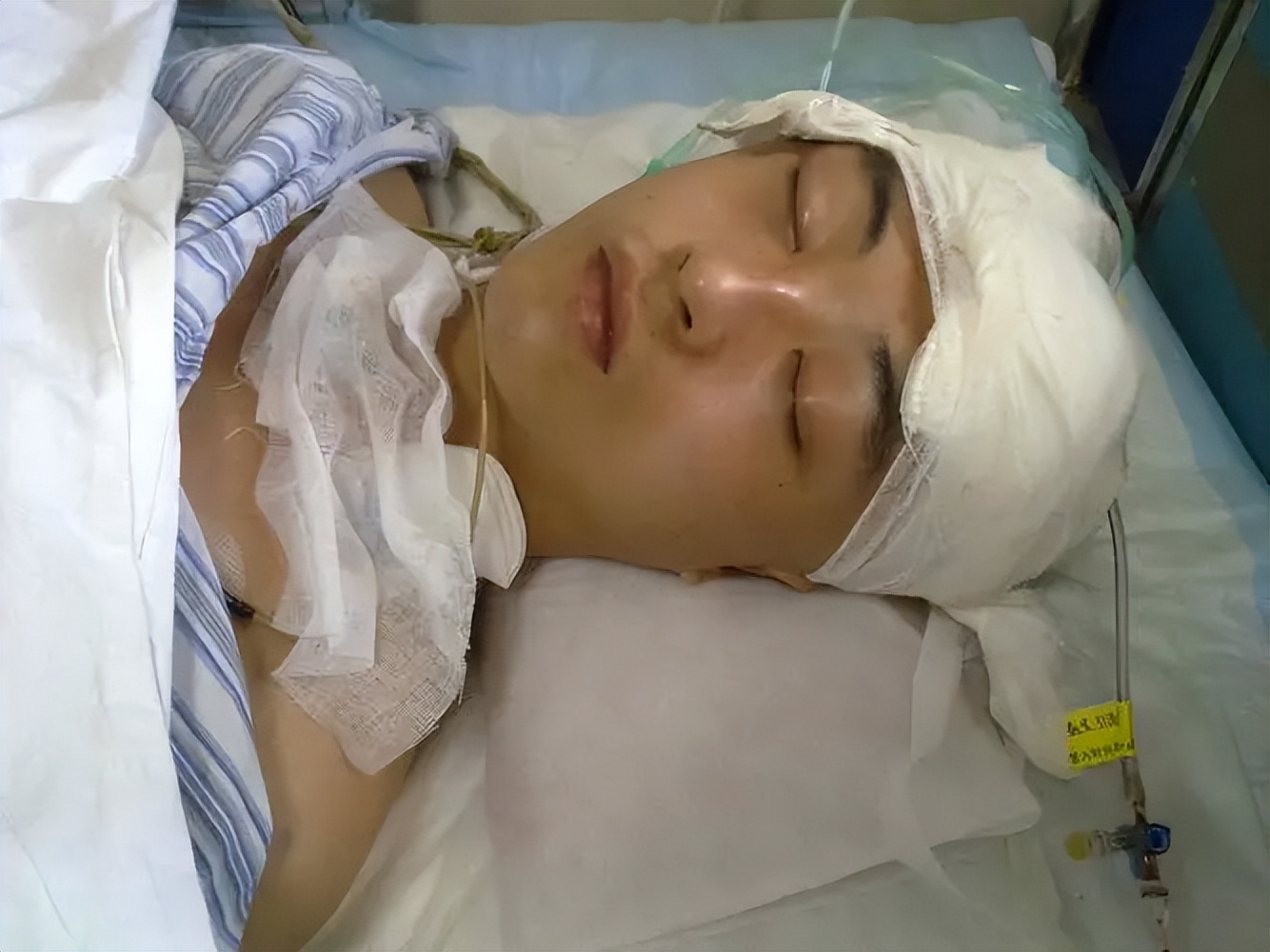 22岁女孩洗完澡突然晕倒后续,22岁女孩洗完澡后昏迷后续