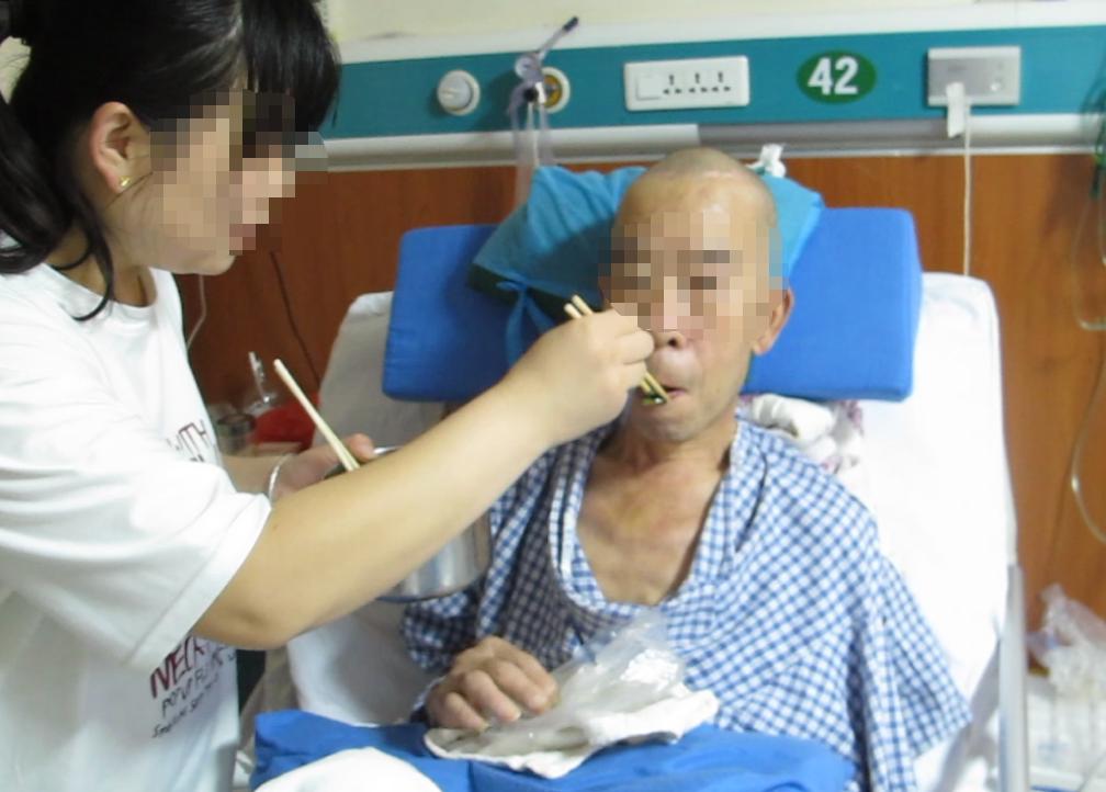 脑外伤后硬膜下积液颅骨修补,颅骨修复手术失败导致脑积水