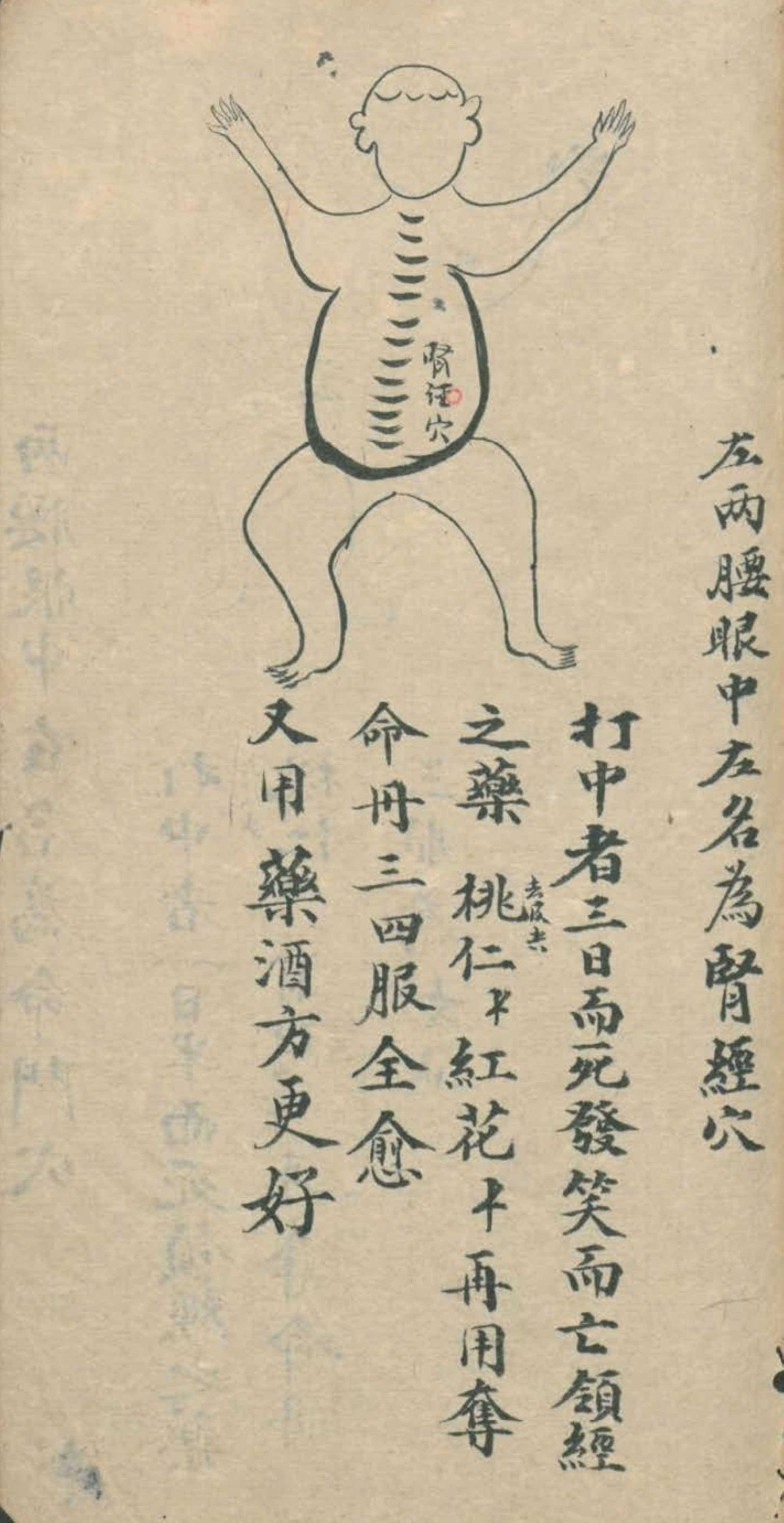 武当秘传跌打八法,民间中医古籍手抄本专医跌打秘方