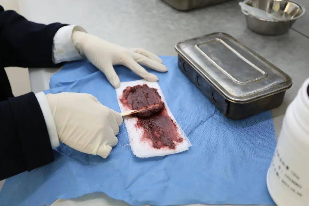 专家总结治疗肛裂的最佳治疗方式,治疗肛裂生肌的药