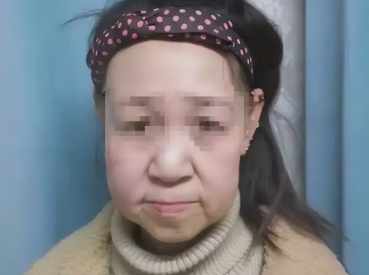 辽宁歪脸女孩，家境贫寒父母双亡，整容变美后拒百万薪只为当老师