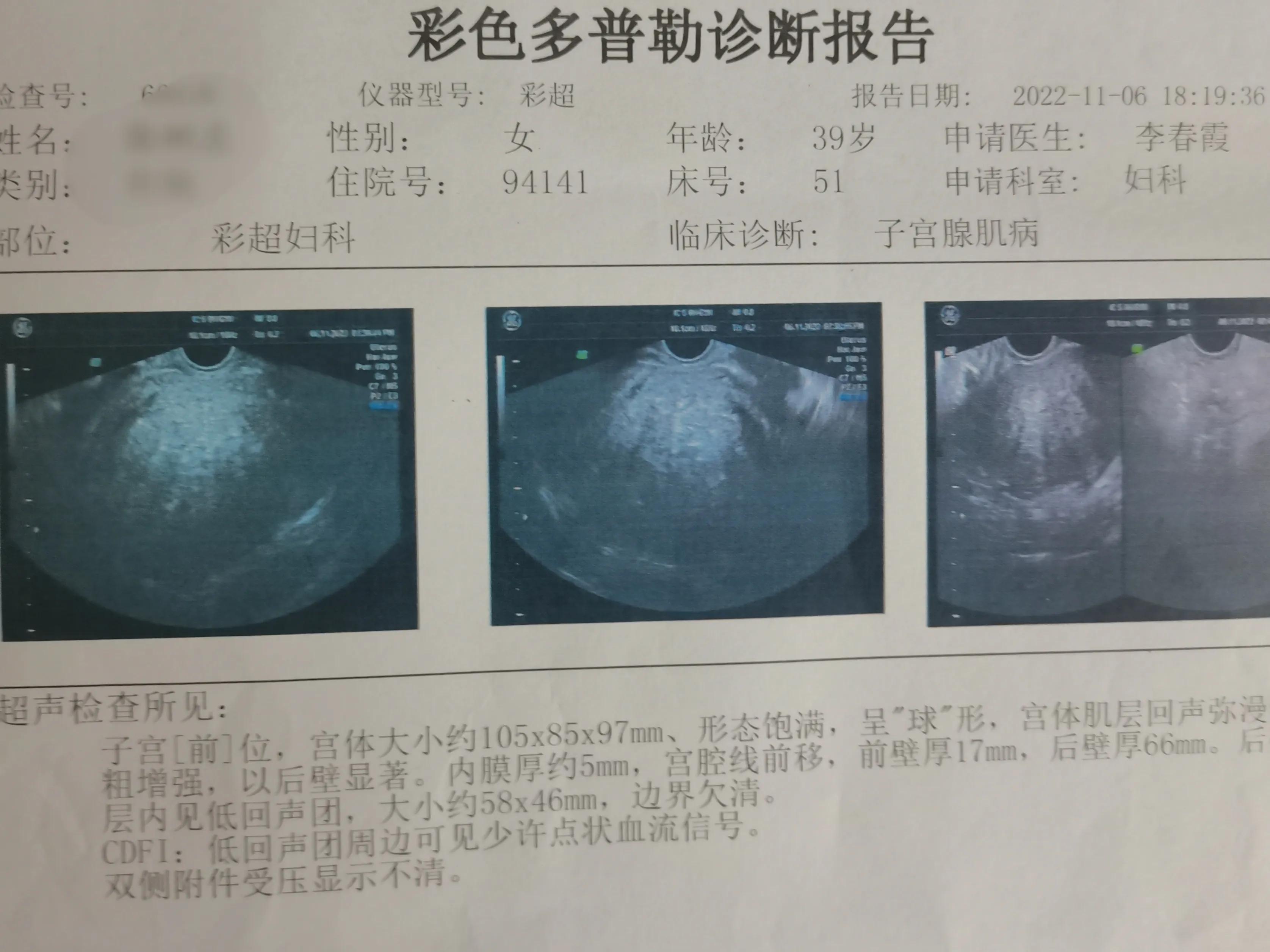广西34岁女人腺肌症,陈女士的抑郁症