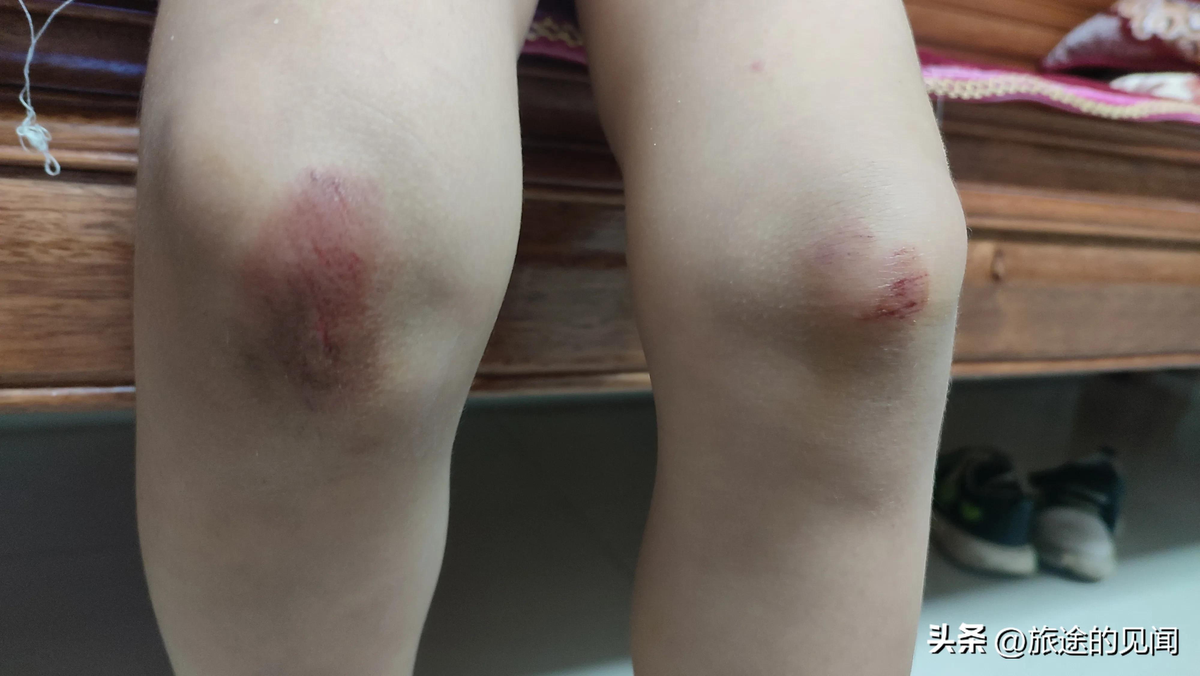 小孩摔了个大跟头,婴儿摔了个大跟头