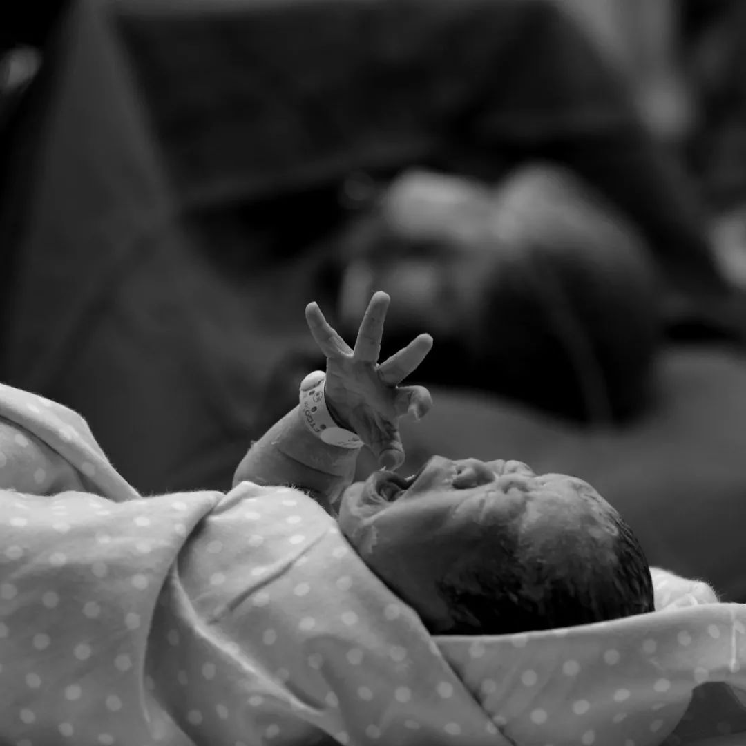 湖南女子怀孕6月没动静，坚持生下发现是猴娃，1岁块头比西瓜小