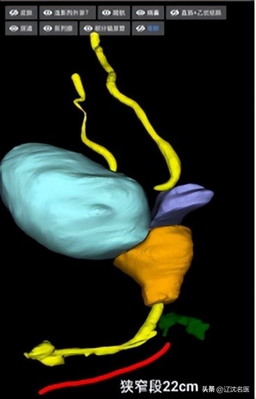 数字化助力优质医疗资源下沉,数字化医疗助力服务质量