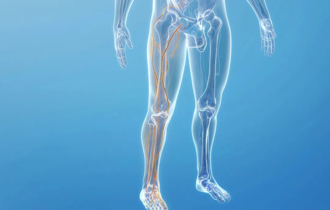 下肢静脉溃疡中医治疗方法,下肢静脉性溃疡护理方法