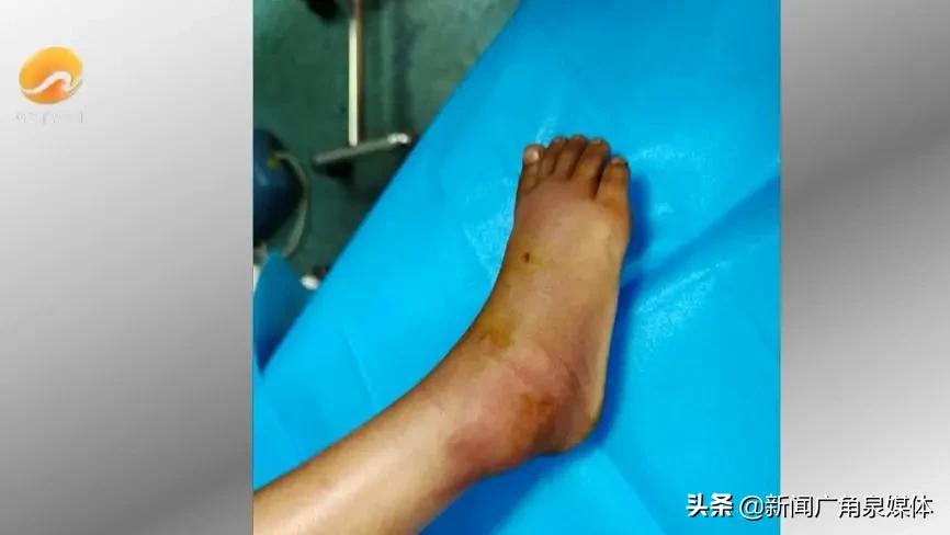 小孩发烧42度导致的死亡事件,4岁小孩突然高烧离世