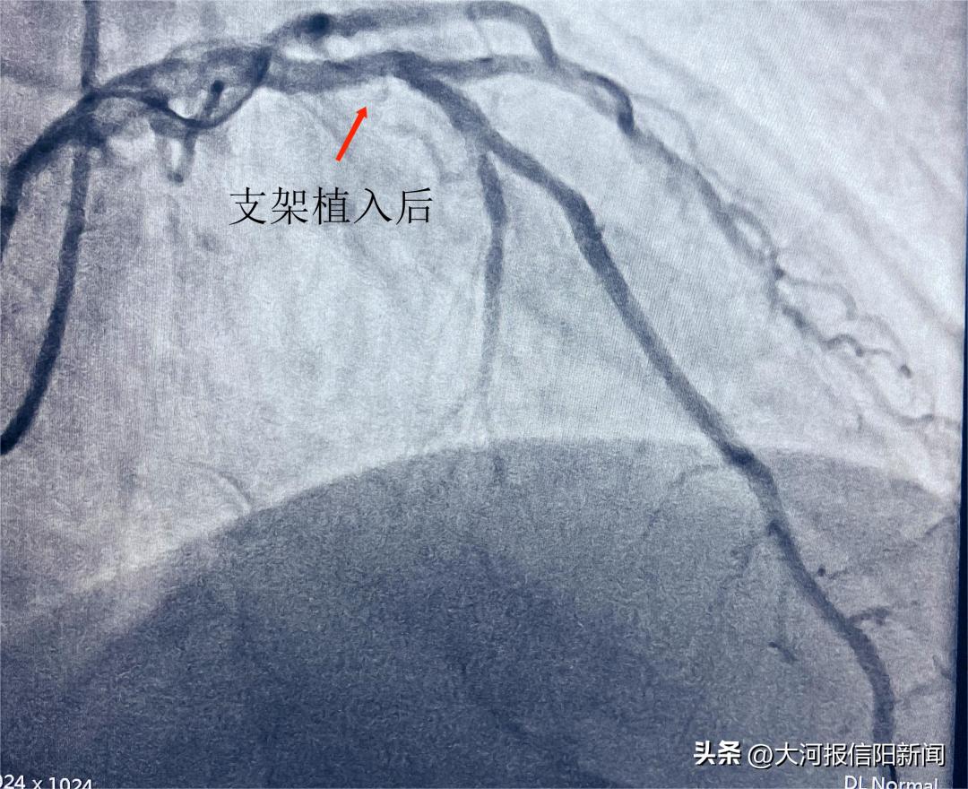 信阳医院手术室及病房净化,信阳中心医院手术室
