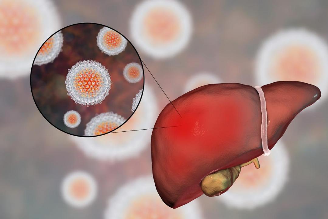 谷草转氨酶和谷丙转氨酶高怎么降,谷丙转氨酶谷草转氨酶高要查什么