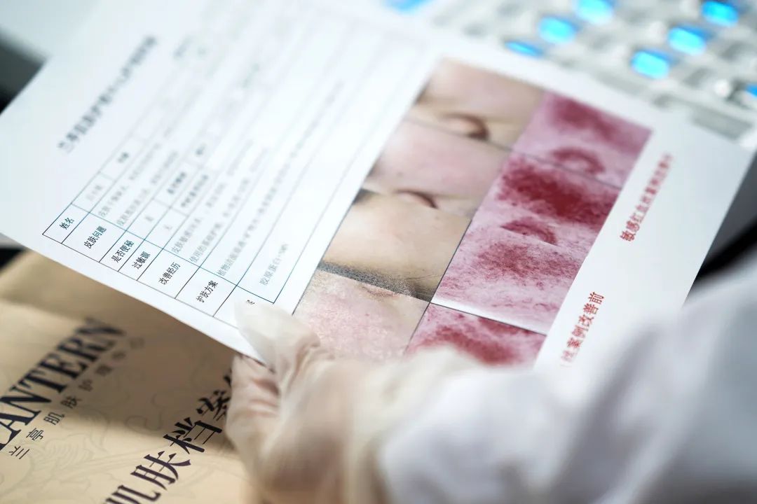 额头有痘痘可以敷补水面膜吗,长痘痘可以敷面膜用精华吗