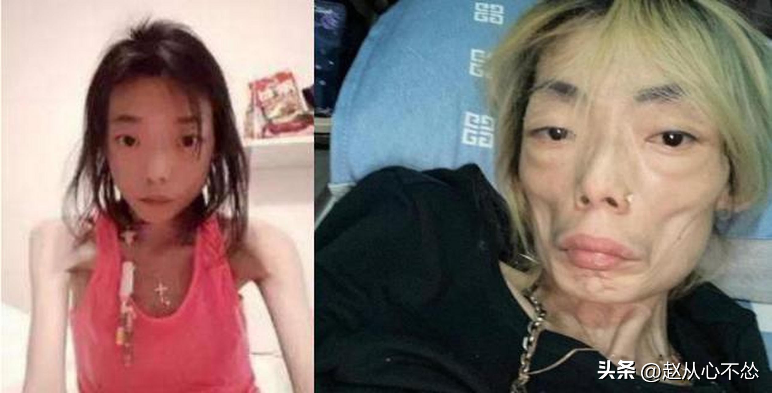 嫁入香港的名模,香港模特嫁富豪后暴瘦