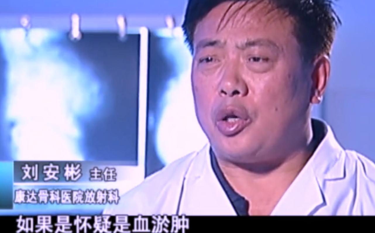 2007年四川90岁老妇，腹中怀子60年未生，后检查发现胎儿没有腐烂