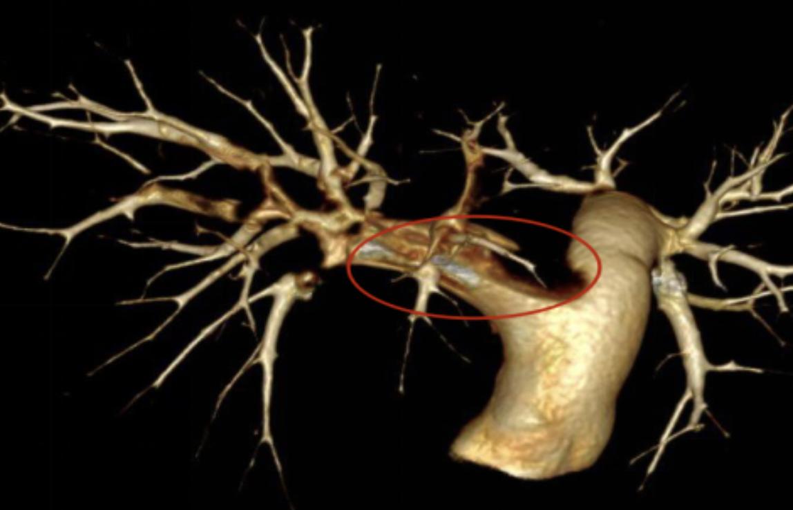 足球伤病拜仁,足球严重伤病