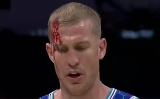 字母恶意肘击再现伤人动作,恶意犯规挥肘提膝伸腿