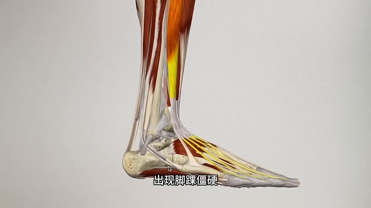 脚踝扭伤无结构损伤需要休息多久,脚踝扭伤恢复后很容易再次受伤