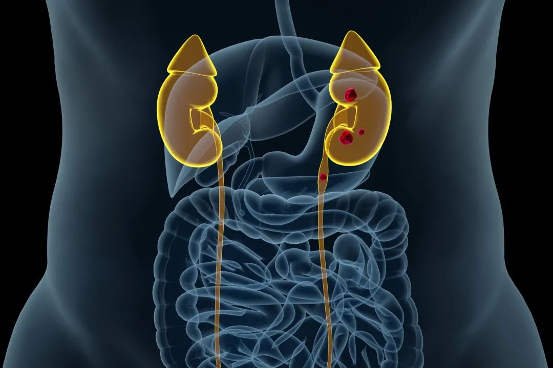 泌尿外科门诊常见病及治疗方案,泌尿外科疑难问题解析