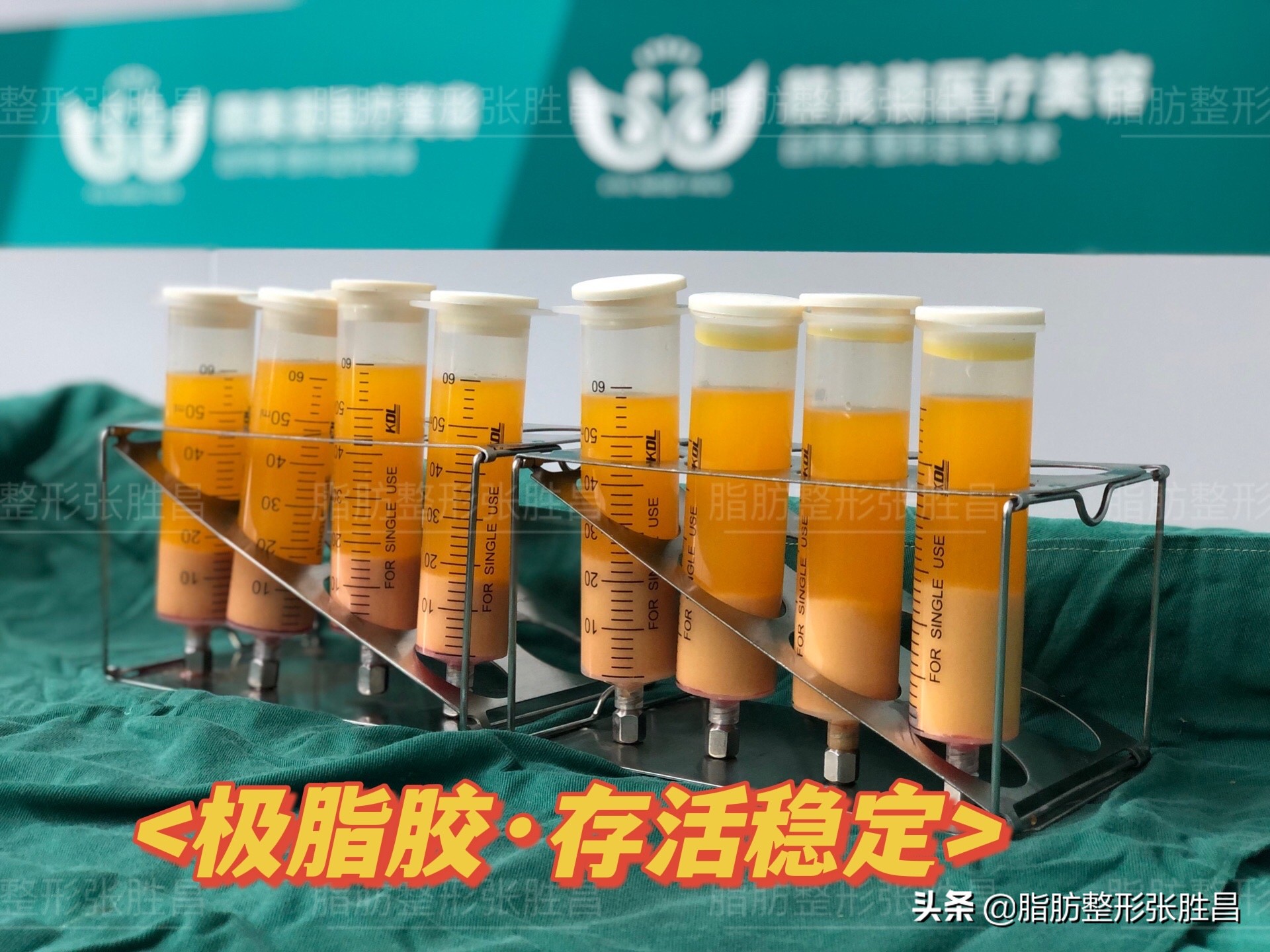 做过脂肪填充的视频,作为做过眼袋手术的过来人