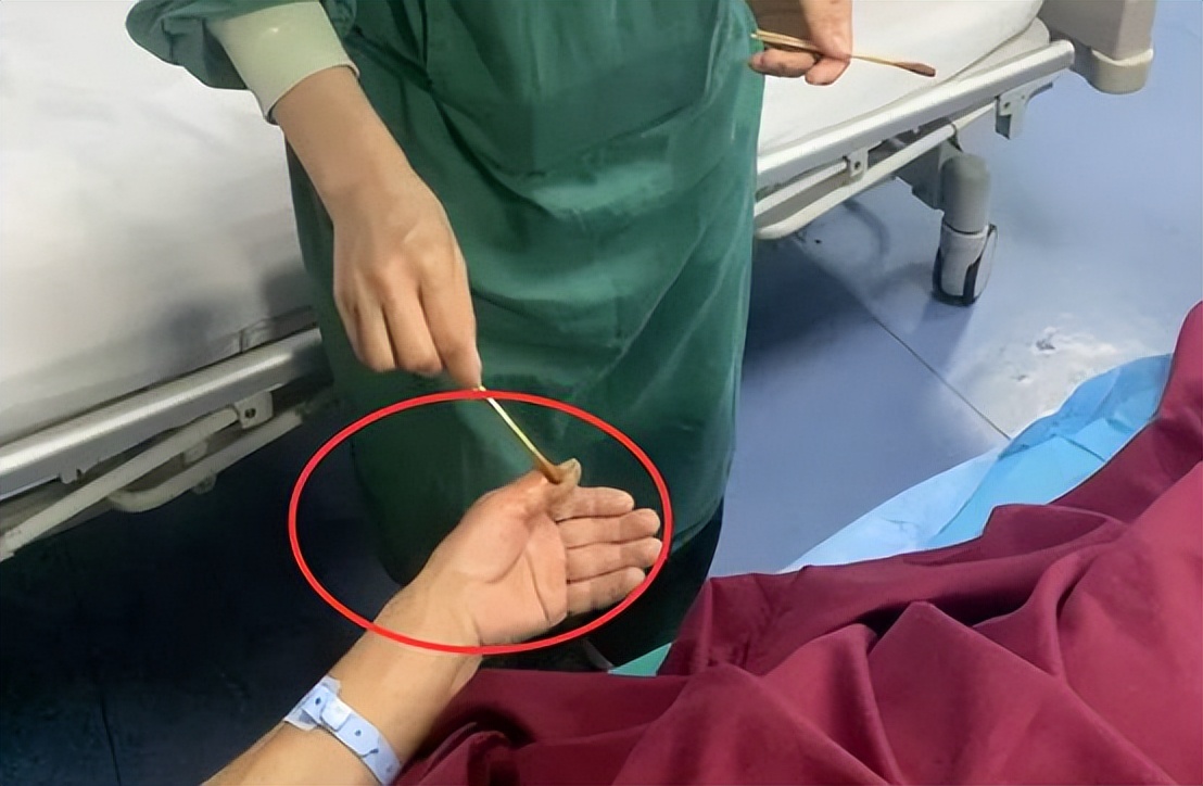 小伙徒手抓竹叶青后续,胆大的小伙用毒蛇咬了会怎么样