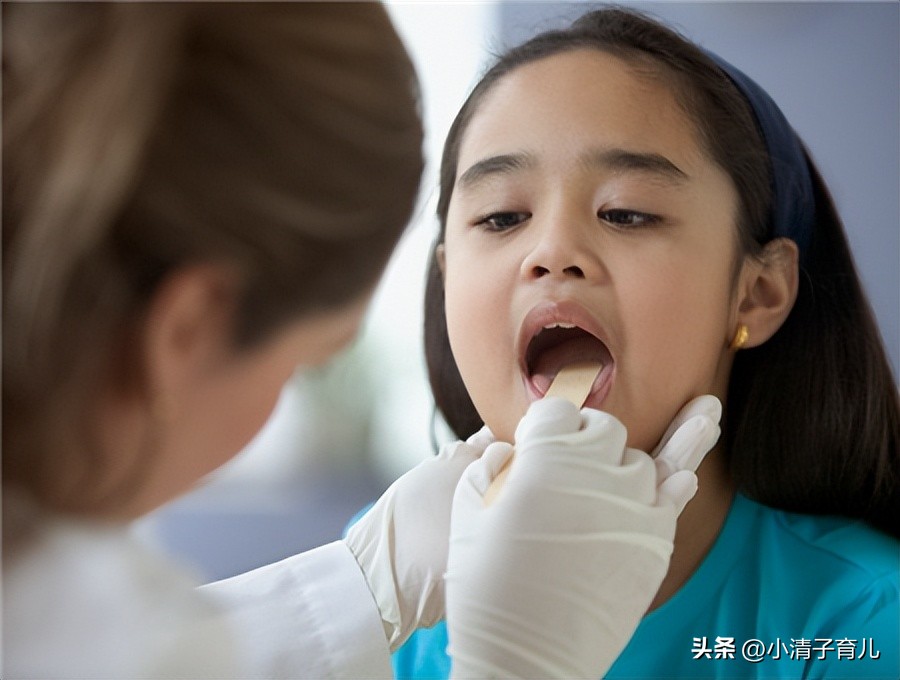 宝宝舌苔又厚又白?有3种原因4种对应的处理方法