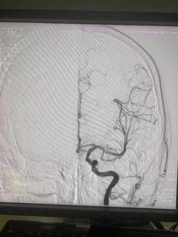 生死时速抢救,生死时速医院手术7小时挽回生命