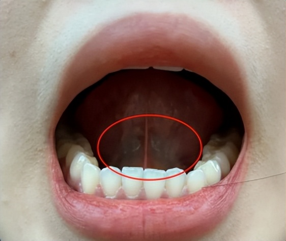 大姨妈提前来是什么原因,大姨妈老是下午来正常吗
