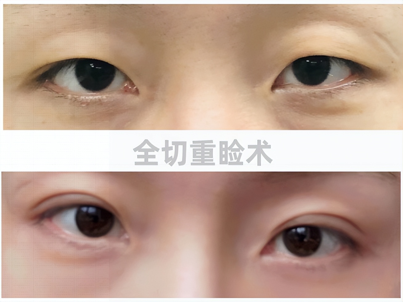 医疗美容变美秘诀,美容科医生教你悄悄变美