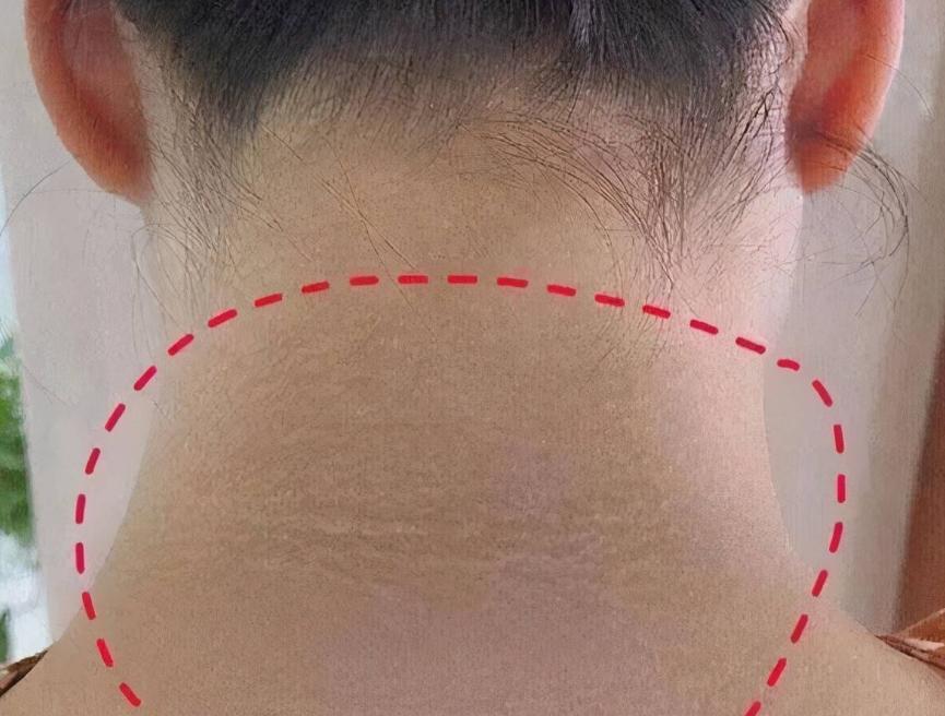 *处私**黑,是因为“经历”太多?医生:别乱猜,或与这4种病有关!