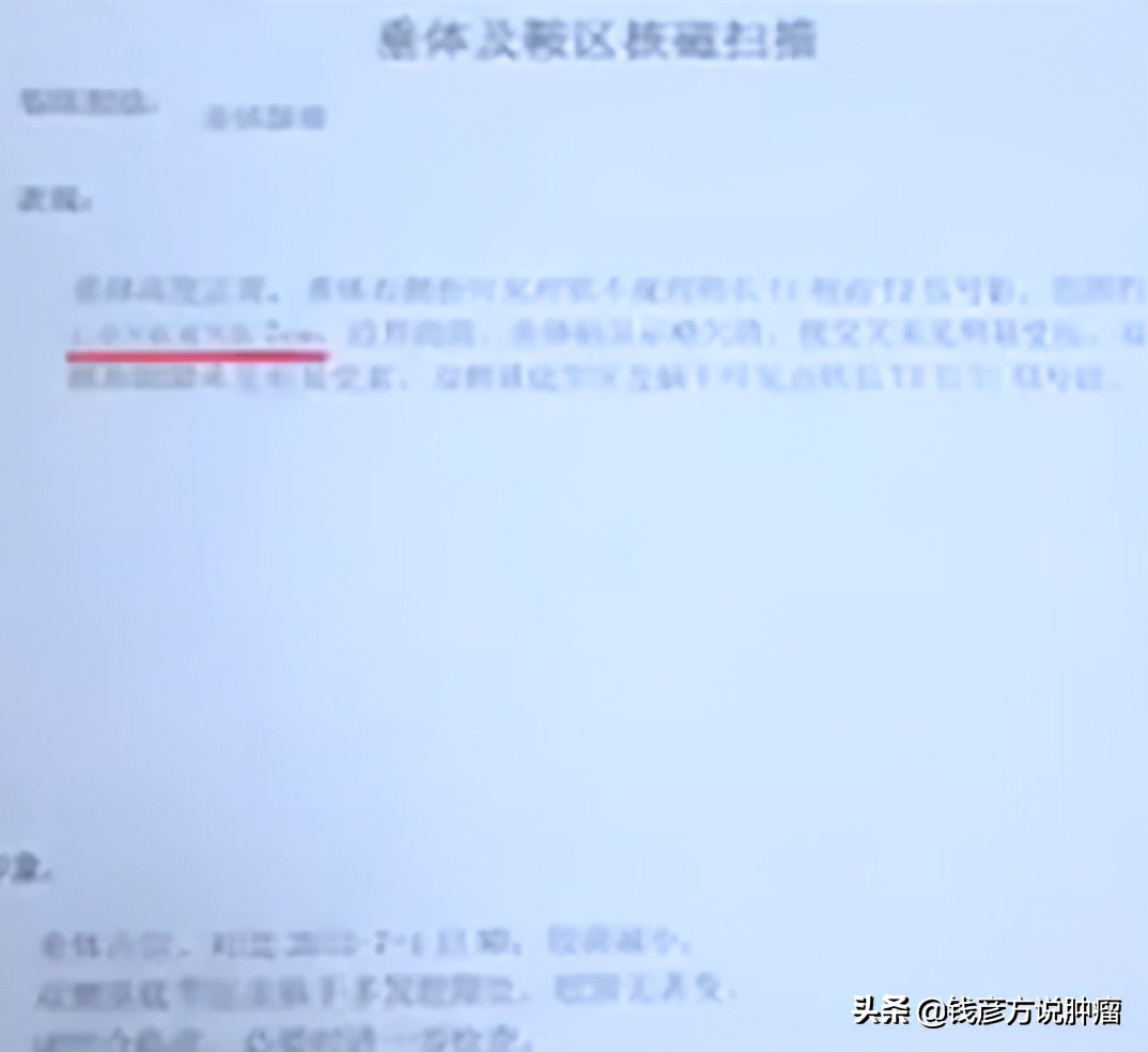 头晕被诊断为脑梗死危险吗,头晕轻度高血压该怎么办