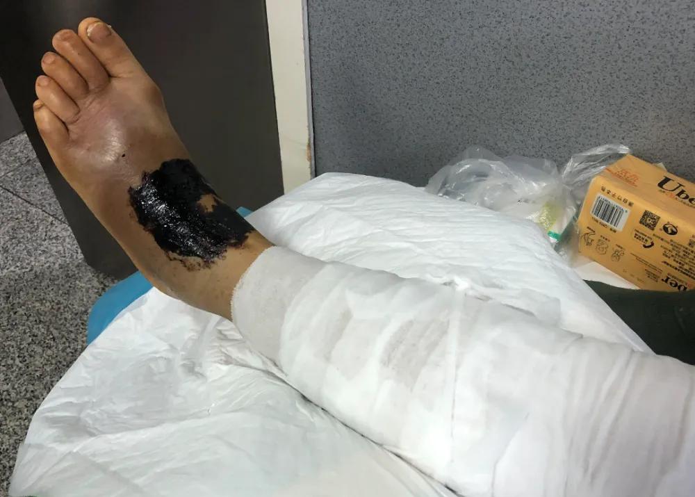 恐怖剧毒蛇吃蛇上演毒蛇互吞大战,罕见蛇吃蛇