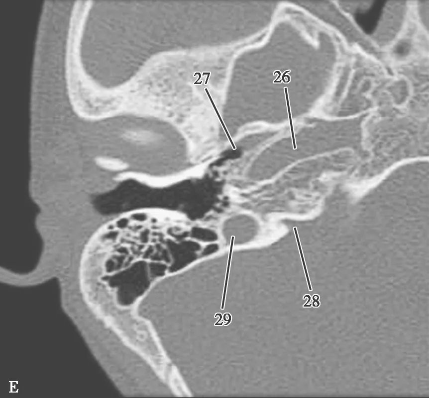 耳部解剖结构和生理功能,耳部解剖笔记