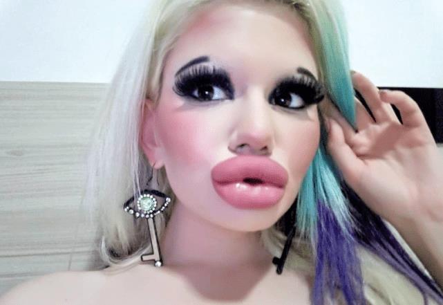 全网最厚嘴唇女网红,整容很多次网红厚嘴唇