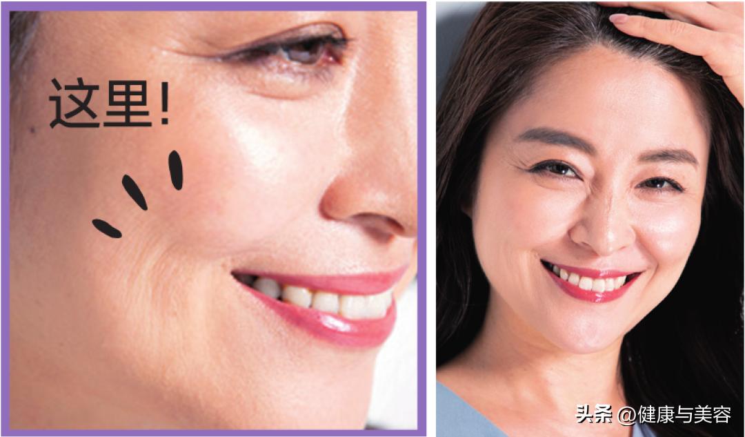 眼部皱纹抗皱,眼部抗衰去皱纹