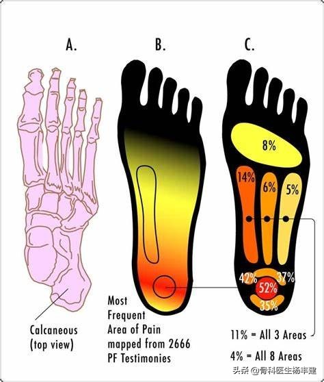 中老年人脚后跟疼是腕管综合征吗,中老年人脚后跟疼痛图片